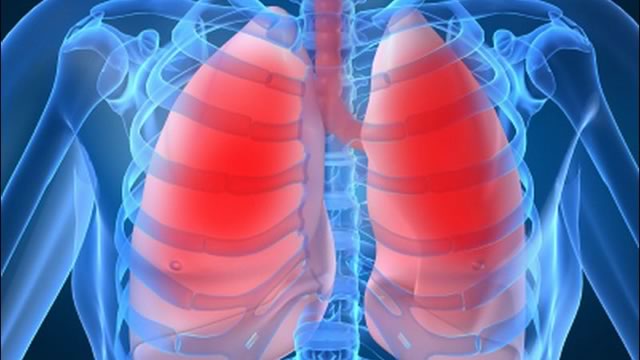Інфекційне загострення бронхіальної астми (БА) та хронічного обструктивного захворювання легень (ХОЗЛ) - HOZL
